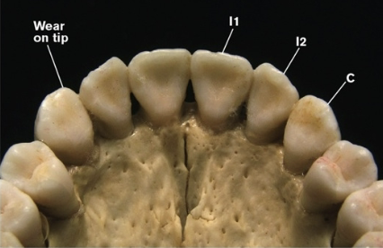 <p>grinding or food, rather than shearing (honing); wear on the tip for canine</p>