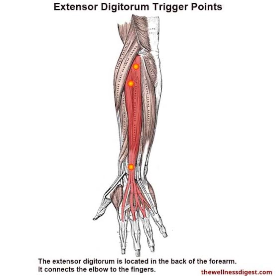 term image