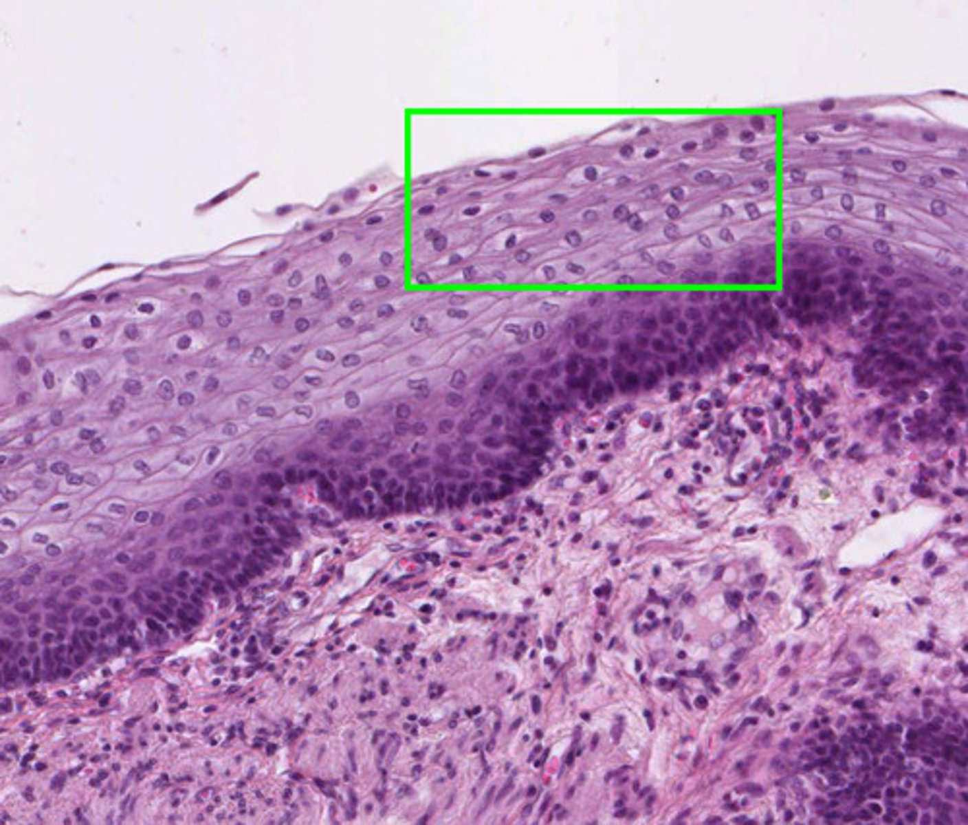 <p>stratified squamous</p>