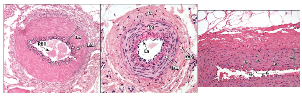 <ul><li><p>Larger than 0.5 mm in diameter</p><ul><li><p>Wavy internal membrane</p></li><li><p>Up to 40 layers of smooth muscle in tunica media</p></li><li><p>Tunica externa has collagen/elastic fibers as well as smooth muscle fibers</p></li></ul></li></ul><p>Distinct fibers in the tunica intima</p>