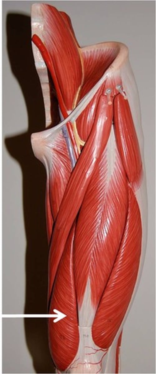 <p>Part of the quadriceps group</p><p>Action - extends leg at the knee; part of the quadriceps group</p>