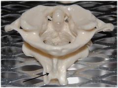 <p>Name this specific part of the axis (C2).</p>