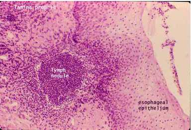 <p>Clusters of lymphoid cells with some extracellular matrix </p><ul><li><p>Not entirely surrounded by a connective tissue capsule</p></li><li><p>Scattered around the body</p><ul><li><p>Found in every body organ </p></li></ul></li><li><p>Help defend against infection </p></li><li><p>In some areas, group together to form larger structures </p><ul><li><p>Example: MALT</p></li></ul></li></ul><p></p>
