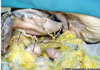 <p>what artery is being indicated to in the image?</p>