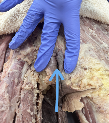 <p><span>the exit point for the body’s waste.</span></p>