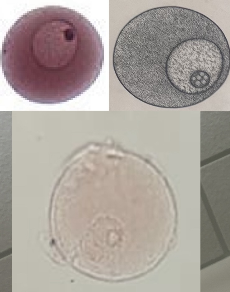 <p>Developmental stage</p>