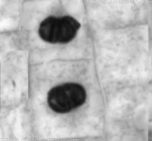 <p>what is this plant cell going through? </p>