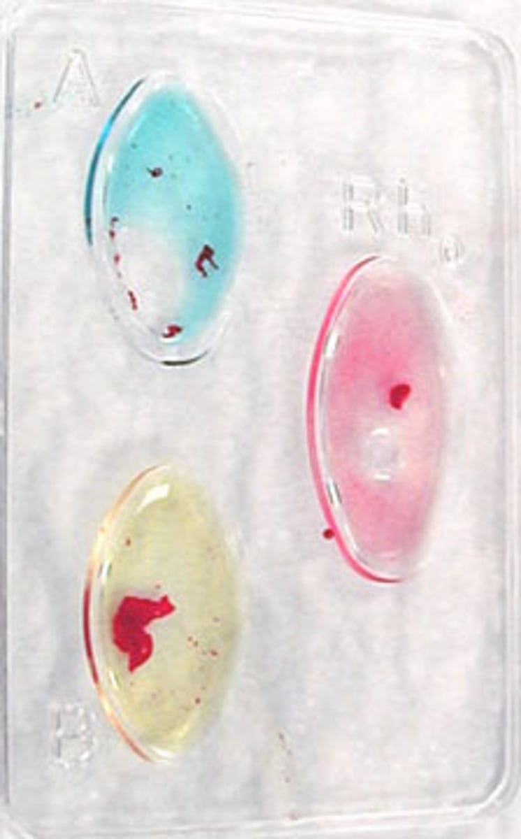 <p>What type of blood is this?</p>