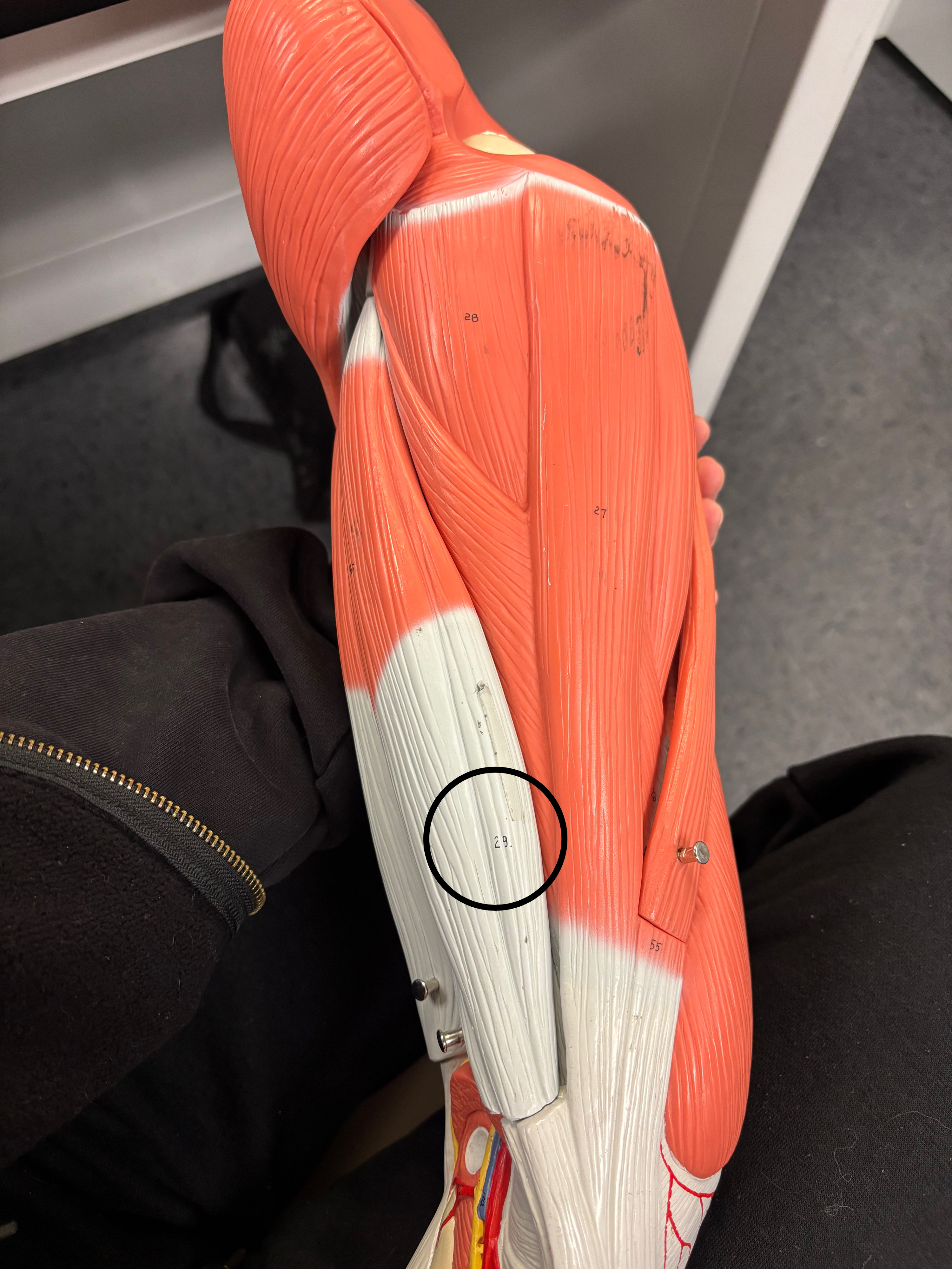 <p>Semimembranosus muscle </p><p>Extension of the thigh at the hip joint, flexion of the leg at the knee joint</p>