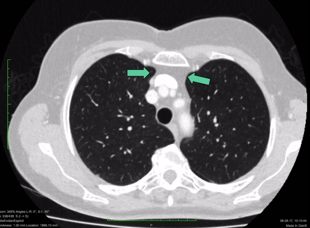 <p>que sont les flèches vertes ?</p>