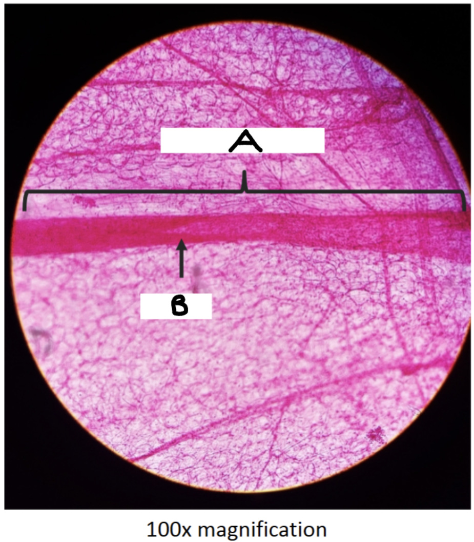 <p>What organ tissue is this? What is A &amp; B ?</p>
