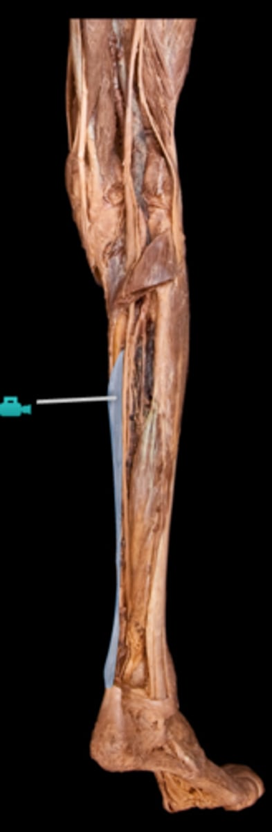 <p>What muscle is this?</p>