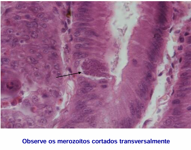 <p>esquizonte de <span style="color: rgb(69, 76, 138);"><em>Eimeria </em></span>no intestino </p>