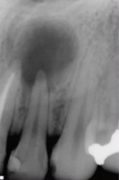 <p>what would be an appropriate first step in managment? </p>