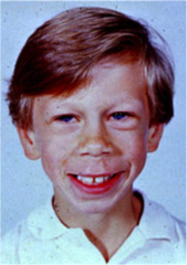 <p>Classically an "elfin" facial appearance</p><p>- Small nose</p><p>- Small chin</p><p>- Wide mouth</p><p>- Long Philtrum</p>