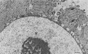 <p>Membrane-bound structures found in the endoplasmic reticulum, responsible for the synthesis and modification of proteins and lipids. </p>