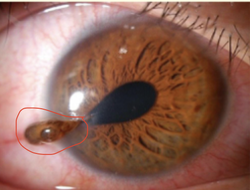 <p>Describe and give diagnosis </p>