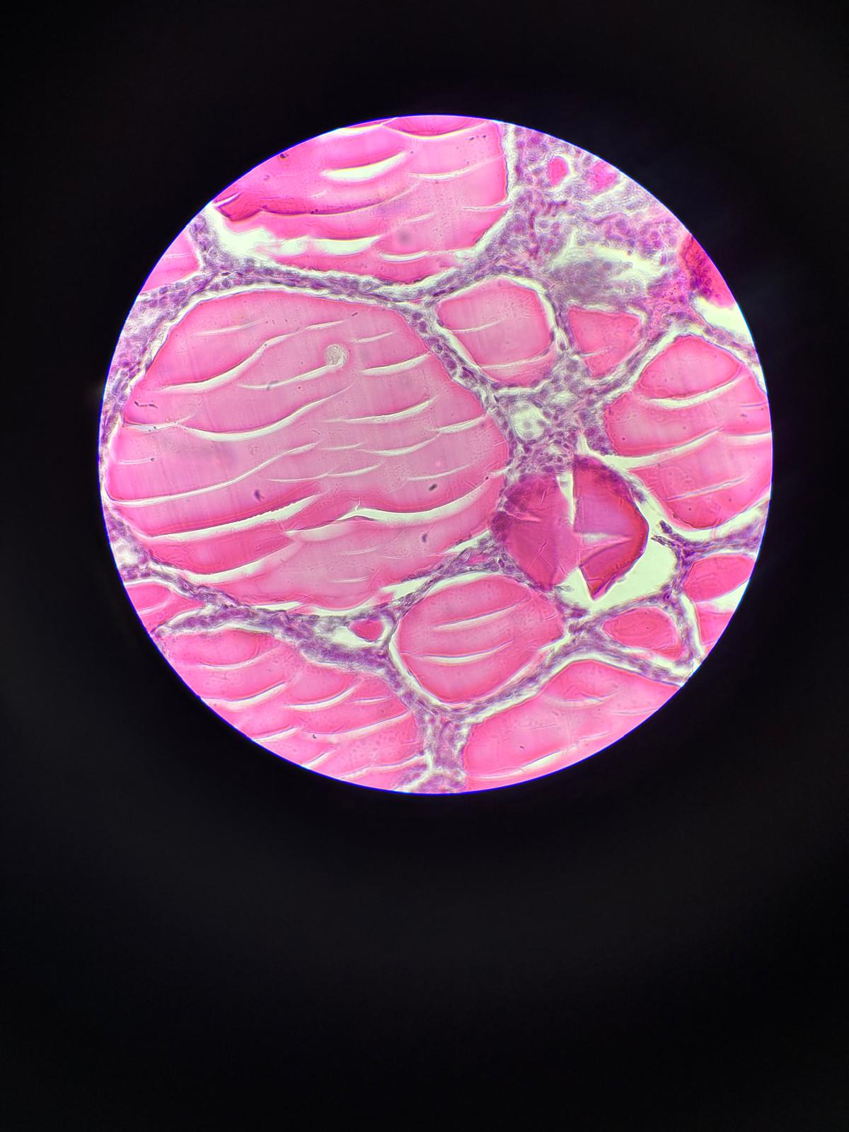 <p>Composed of follicles containing Colloid and lined by follicular cells.</p>