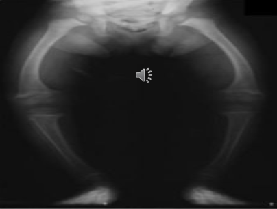 <p>What is the pathology?</p>