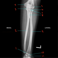 <p>What is labeled 10?</p>