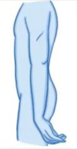 <p>screen for</p>