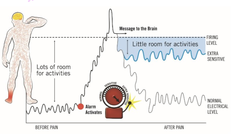 <ul><li><p>analogy</p><ul><li><p>pain is like an alarm system on a house</p><ul><li><p>like for a burglar breaking in</p></li></ul></li><li><p>during healing, the alarm system becomes more sensitive because it doesn’t want more damage —> might go off for potential damage</p><ul><li><p>ex: the mailman </p></li></ul></li><li><p>this is normal</p></li></ul></li><li><p>however, it is not normal when the nervous system is still super sensitive way past the tissue healing time. </p><ul><li><p>like at 6 months, when tissue healing has occurred</p></li></ul></li><li><p>pain is worse when stressed out</p></li><li><p>the threshold for signaling pain has decreased and is easier to trigger</p></li></ul><p></p>
