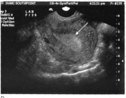 <p>Identify the endometrial phase</p>