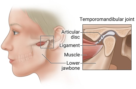 <p>Temporomandibular joint (TMJ)</p>