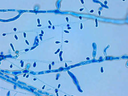 <p>“tear-drop” microconidia</p>