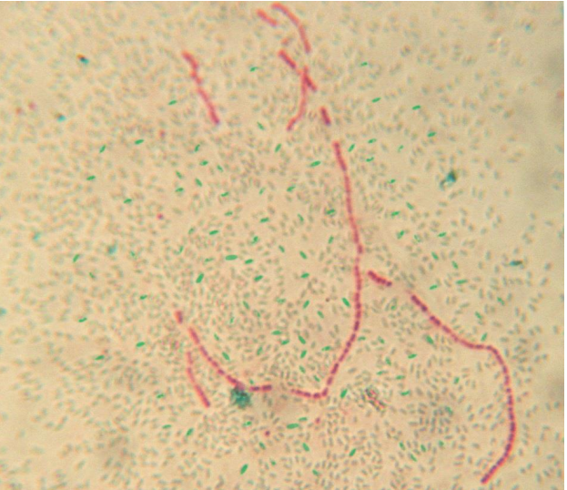 <p>Endospore stain of Bacillus</p>
