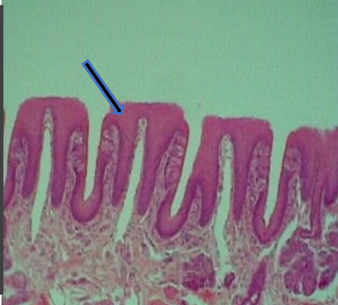 knowt flashcard image