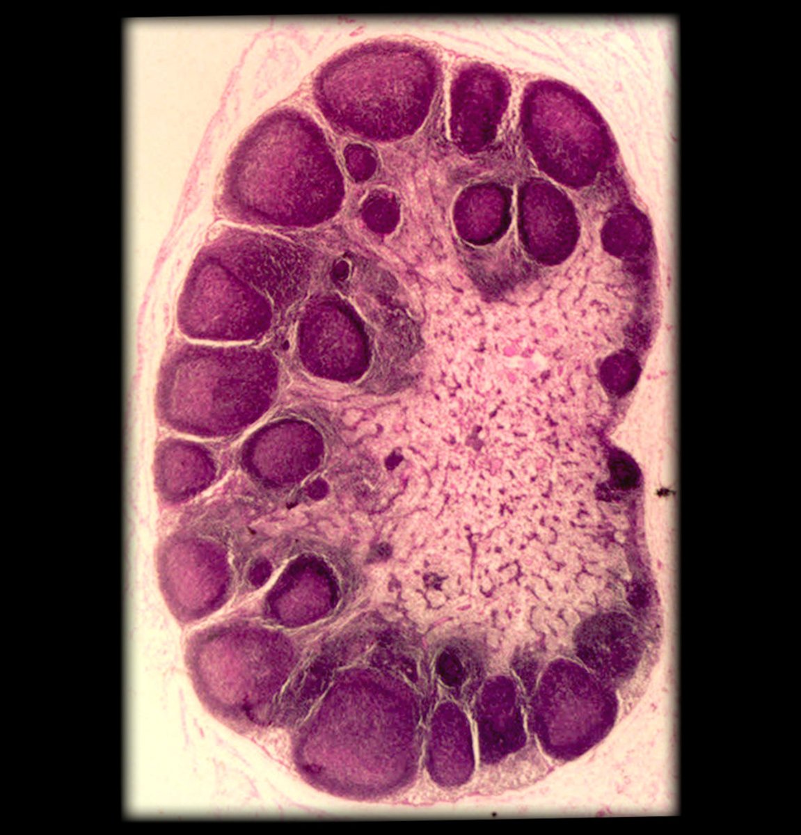 <p>What is this histology slide showing?</p>