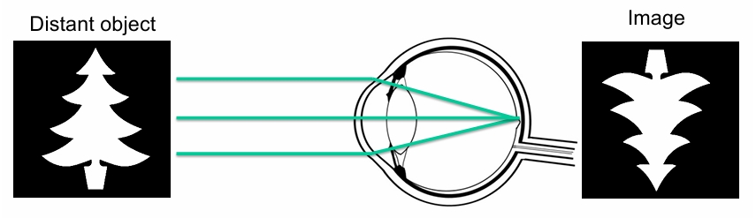<p>Normal focusing</p><p>The emmetropic eye can focus light from a distant object on to the retina. </p><p>• The image at the retina is sharp (in focus)</p>