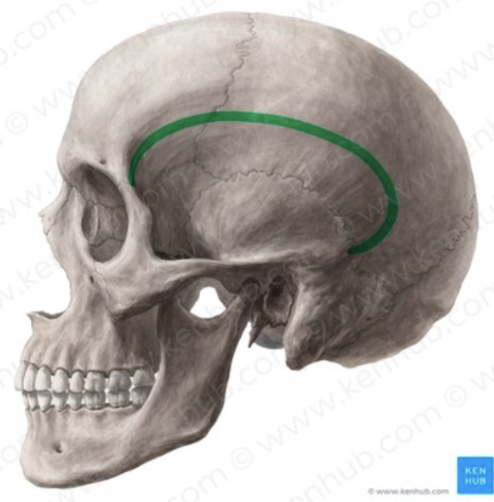 <p>shallow depression on the lateral aspect of skull  </p>