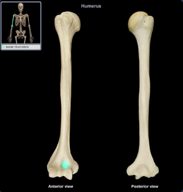 <p>shallow depression</p>