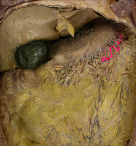 term image