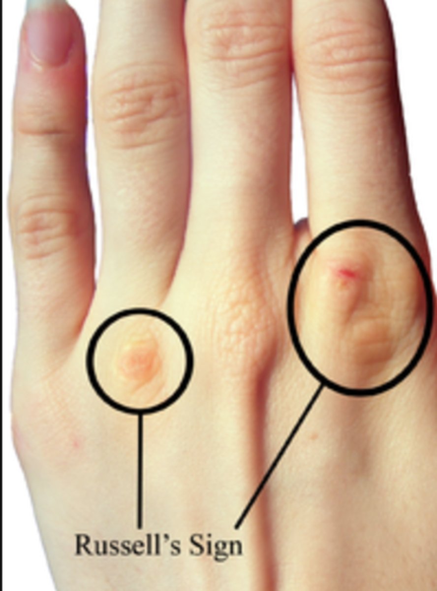 <p>the joints in your fingers, including the ones where your fingers join your hands</p>
