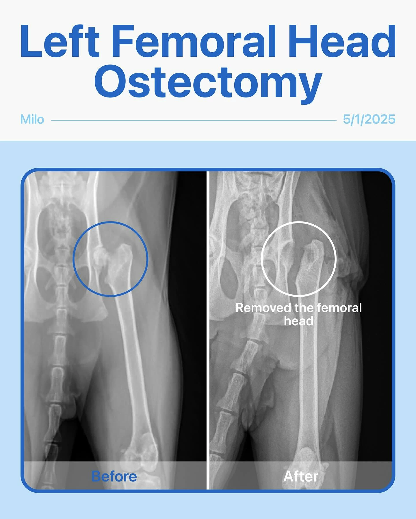 <p>Femoral head ostectomy</p>