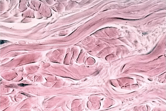 <p>fibers running in many different directions (cells may appear smushed on other diagrams)</p>
