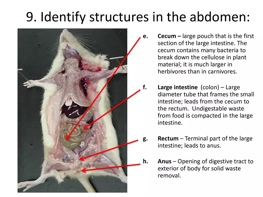 <p>Rectum</p>
