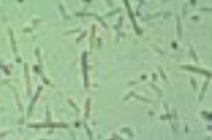 <p>Slender needles, typically antibiotic related</p><p>Normal, Seen in acidic urine</p>