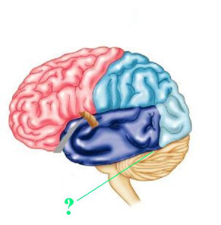 <p>Identify the indicated groove of the brain</p>
