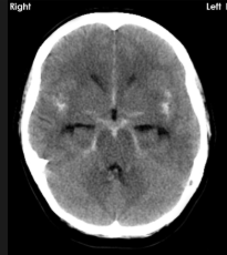 <p>what is the diagnosis?</p>