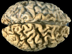 <p>whole</p>