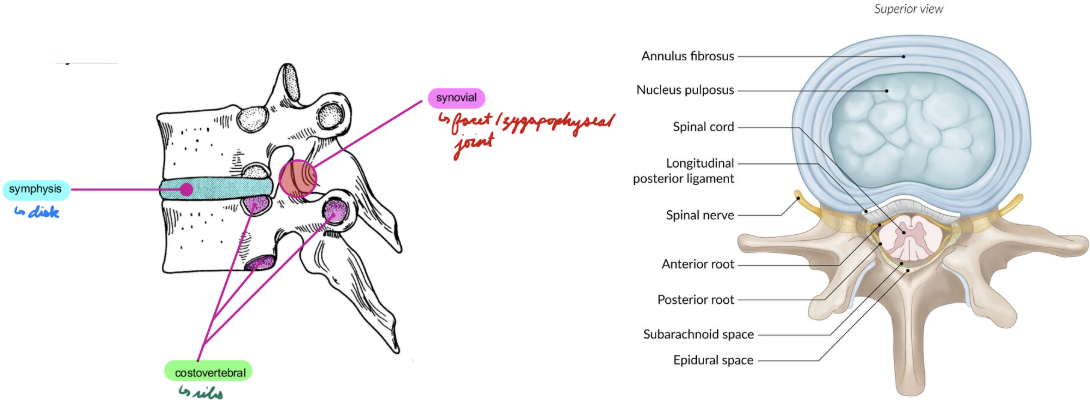 <p>Fibrocartilage intervertebral discs</p><p>Between adjacent vertebral bodies</p><ul><li><p>Upper thoracic → Lumbar: Thin → Thick</p></li></ul><p>Absorb shock</p><p>Contain:</p><ul><li><p>Nucleus Pulposus: Gelatinous core</p></li><li><p>Annulus Fibrosus: Outer fibrocartilaginous lamina</p></li></ul><p></p>