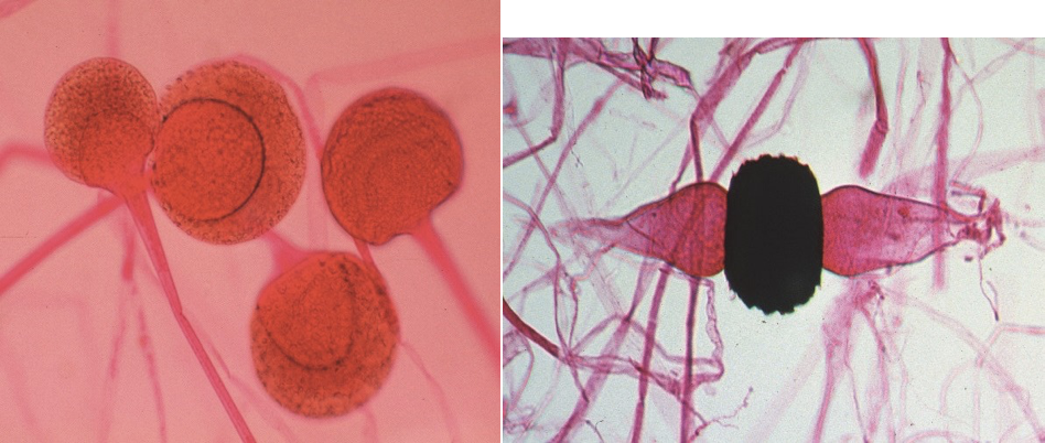 <p>Rhizopus nigricans transmission route</p>