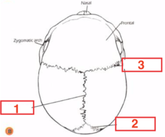 <p>What structure is 1?</p>
