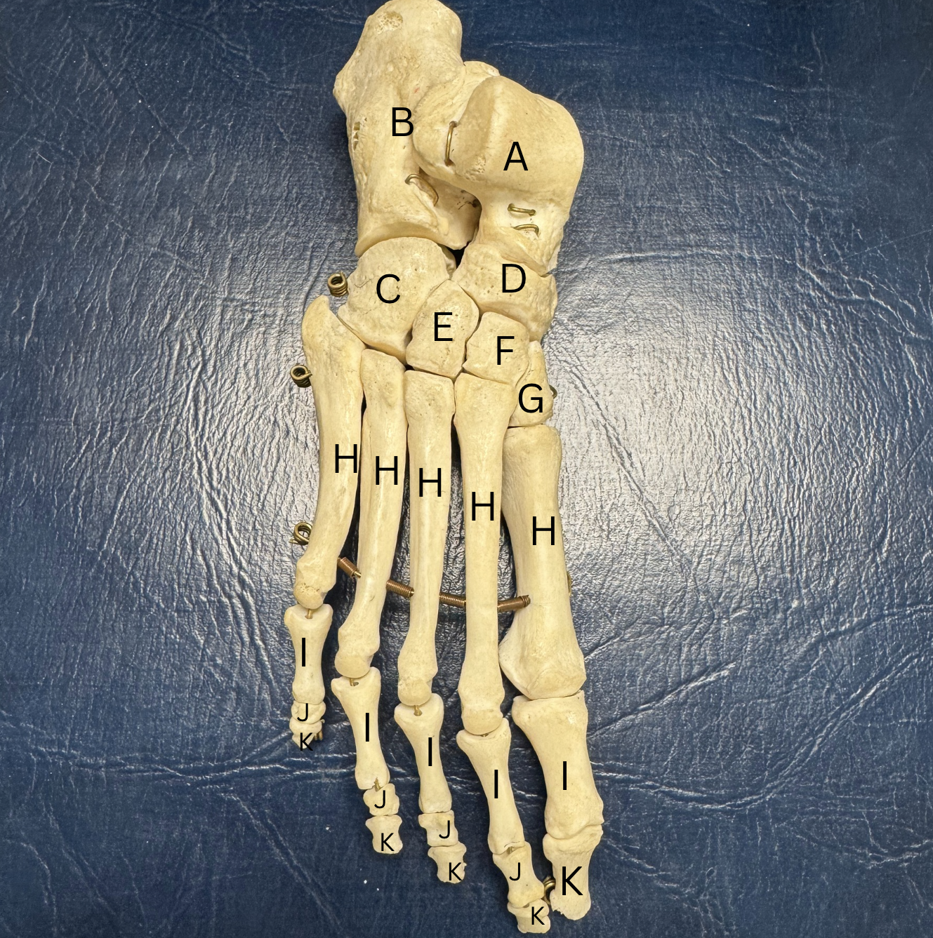 <p>Label the bones of the feet </p>