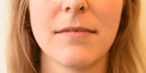 <p>Mouth Stretch</p>