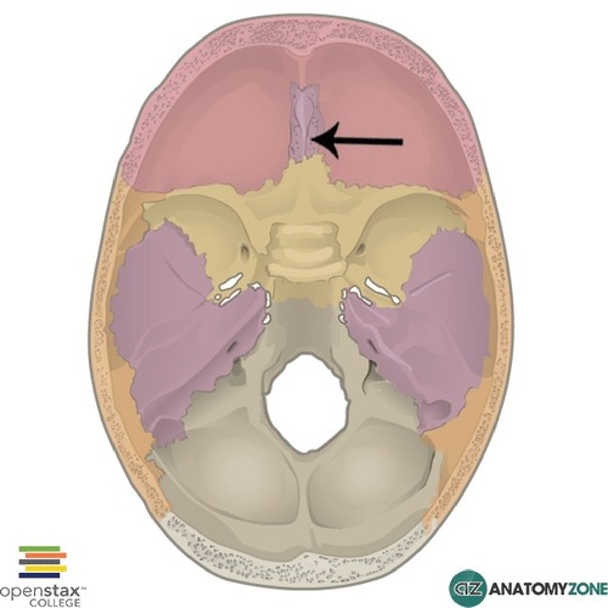 <p>Skull Opening:</p><p>Cribriform Plate</p><p>Main Function:</p><p>Smell</p><p>Clinical Correlation: </p><p>Ethmoid fracture</p><p>Classic Symptoms:</p><p>Anosmia, CSF leak </p>